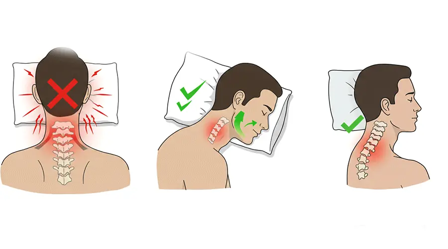 A person sleeping on their stomach (prone), with their head completely turned and their neck strained/crooked. This position is marked with a red 'X' to indicate it is incorrect.